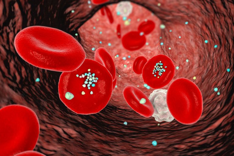 በልብ ህመም ለሞት መዳረግን ያባባሰዉ