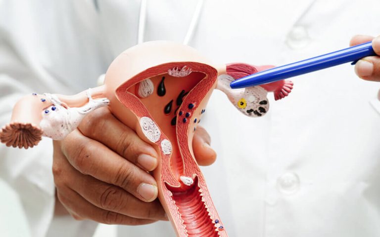 የማሕጸን በር ካንሠር